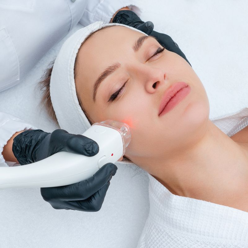 Cosmetic Laser Treatments