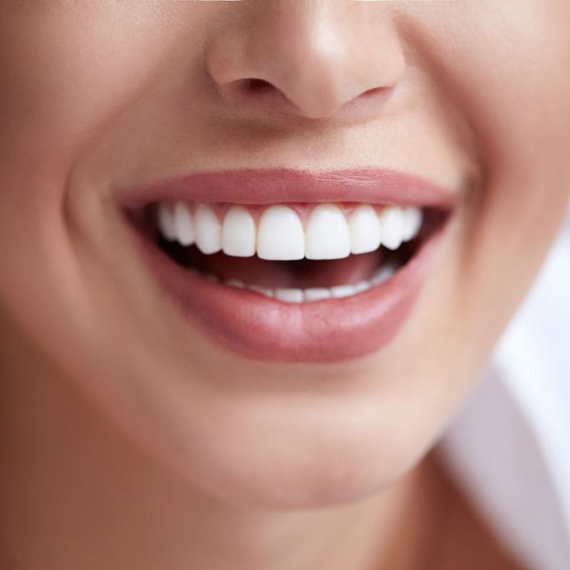 The Connection Between Dental Cleanings and Overall Health