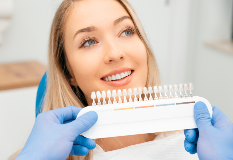 Common Signs You May Need a Dental Veneer